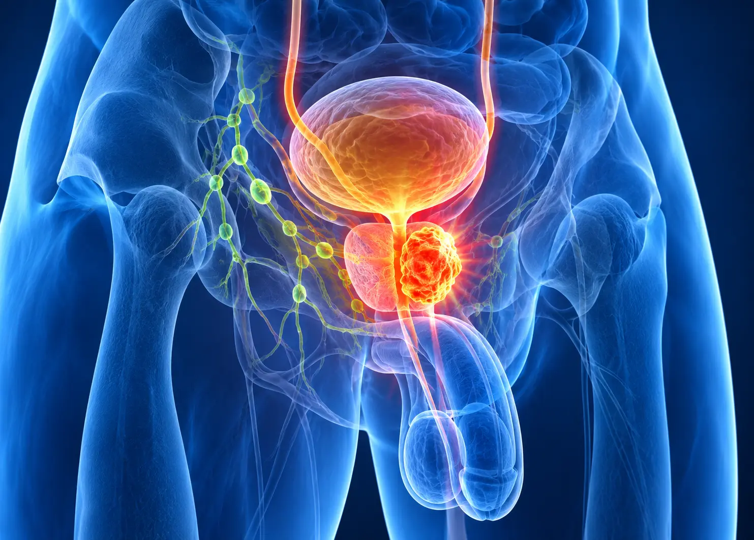 Doctor discussing cancer care with a patient